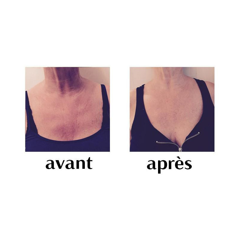 Patch Anti-Rides Décolleté -